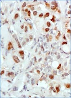 MDM2/HDM2 Antibody (SMP14) - Azide and BSA Free, Novus Biologicals 0.1